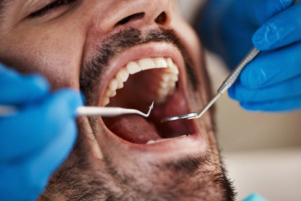 Best Cracked Tooth Emergency Dentist  in Falling Waters, WV